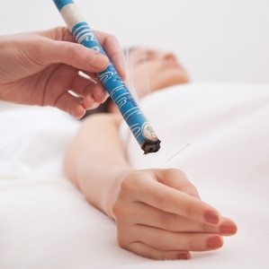 Moxibustion (Moxa)
